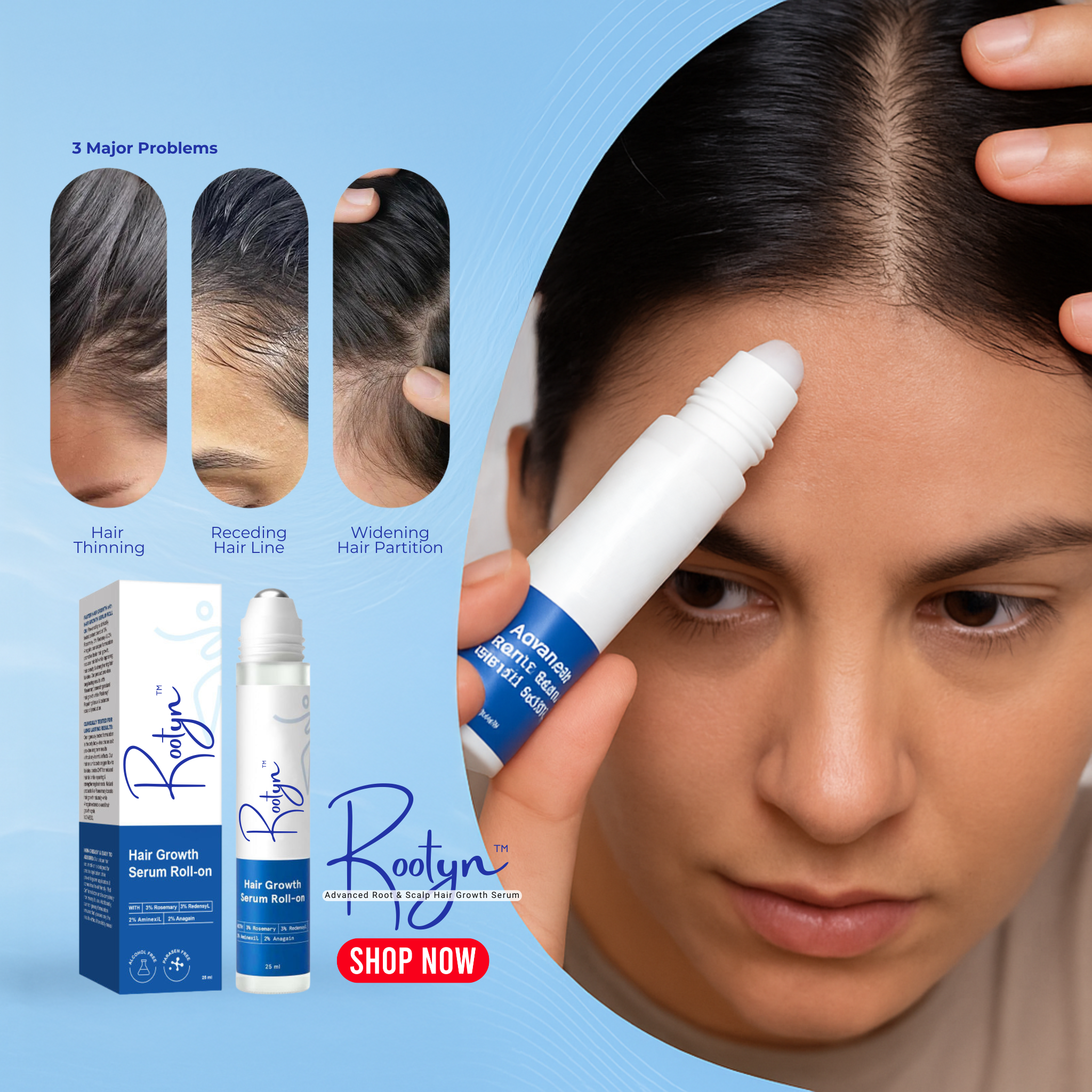 Rootyn™ Advanced Root & Scalp Hair Growth Serum