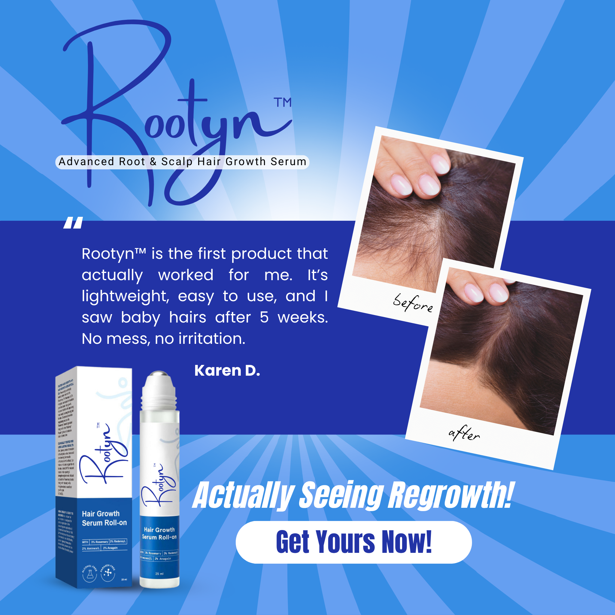Rootyn™ Advanced Root & Scalp Hair Growth Serum