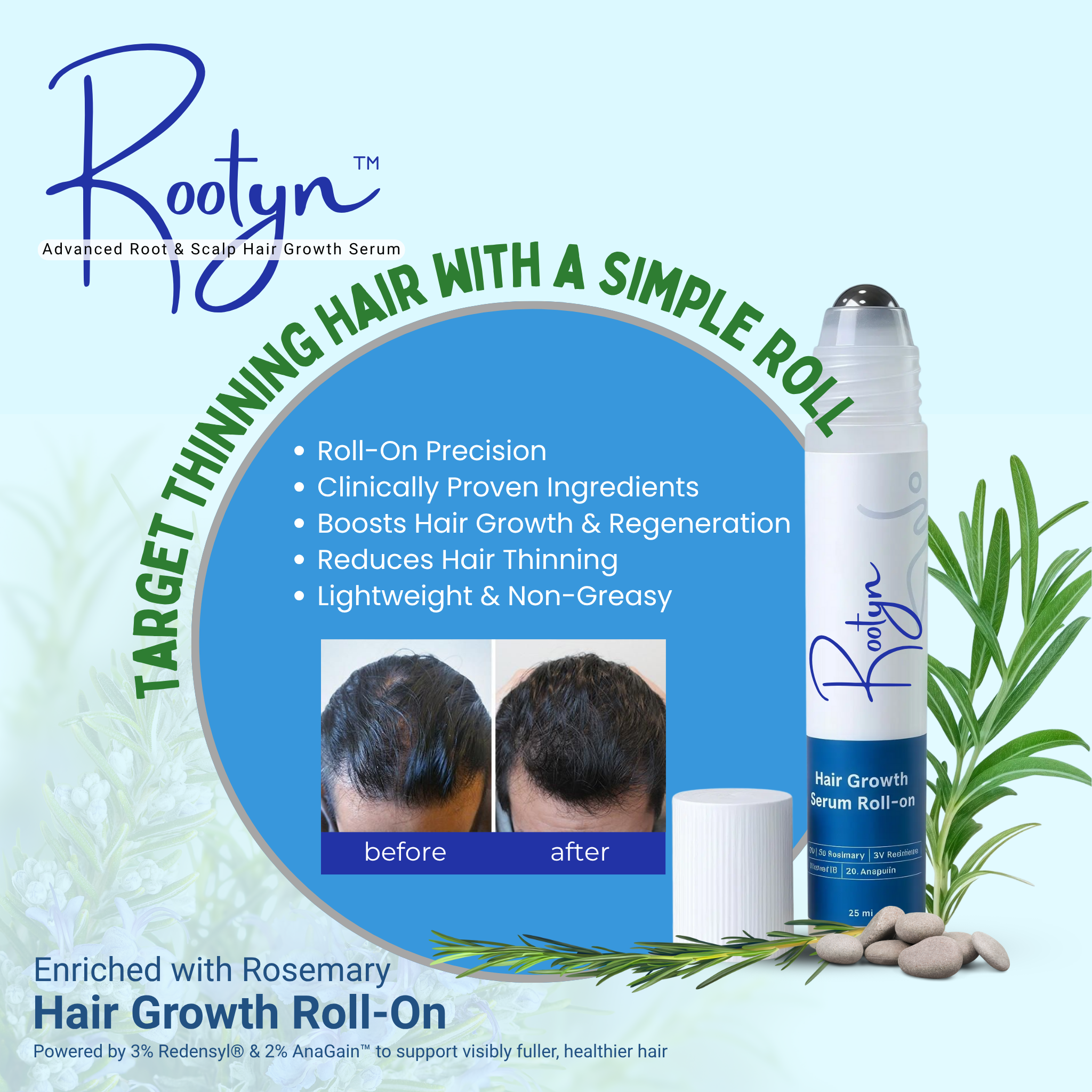 Rootyn™ Advanced Root & Scalp Hair Growth Serum