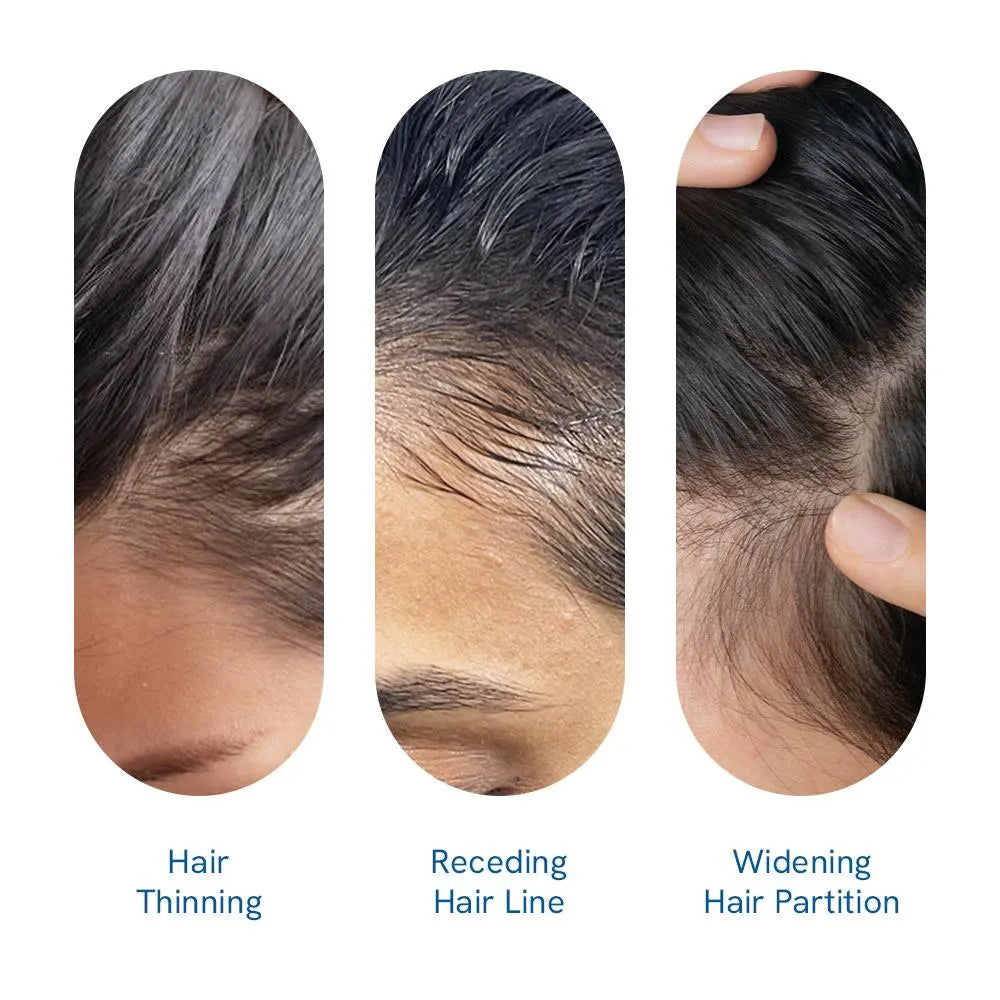 What’s Causing Your Hair to Thin and Loss?